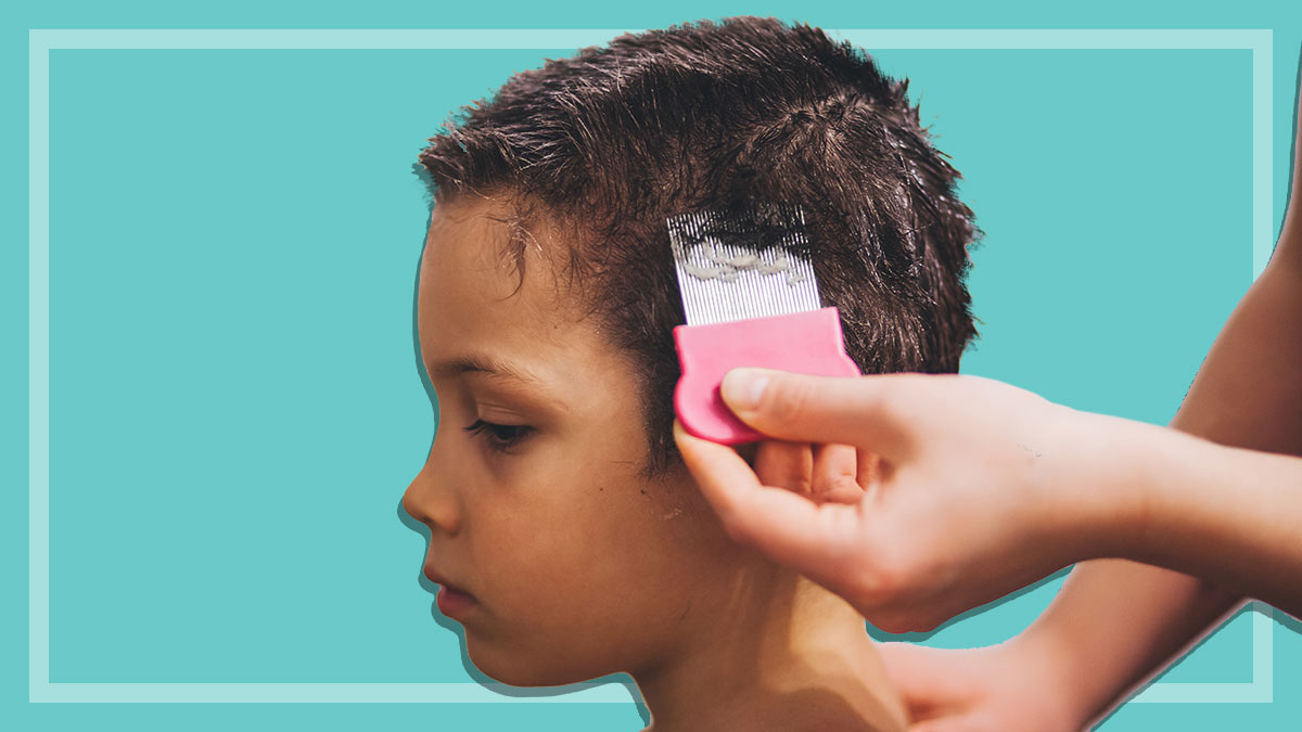 How To Get Rid Of Headlice Choice